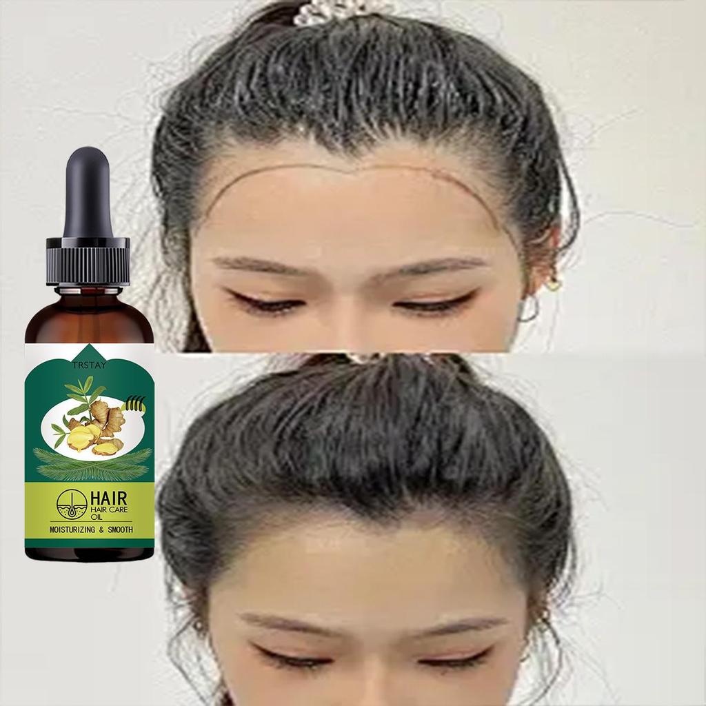 Anti Hair Loss Liquid for Men and Women Hair Firming Essential Oil Nourishing Hair Repair Essence Hair Growth Liquid