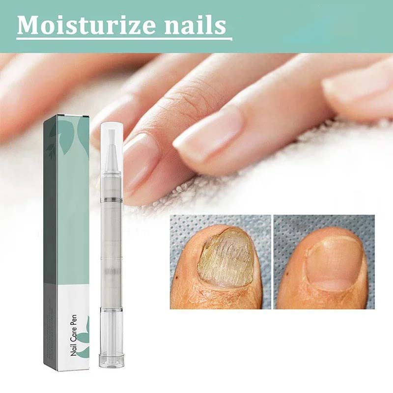 4ml Nail Repair Pen Anti Nail Dry Foot Serum Moisturizing Feet Care Nail Repair Toenail Care Tool Nail  Strengthening Serum Nails Nutrition Oil