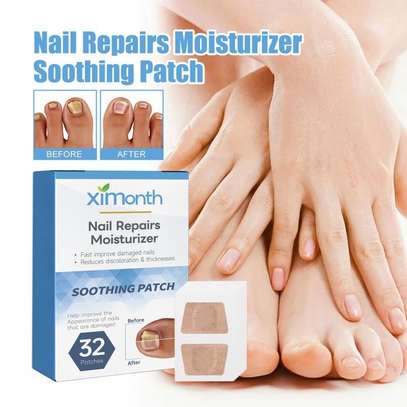 Ximonth Nagelreparatur-Pflaster Weiches Gel Verdickende Nagelpflege Zur Behandlung von Pilzinfektionen