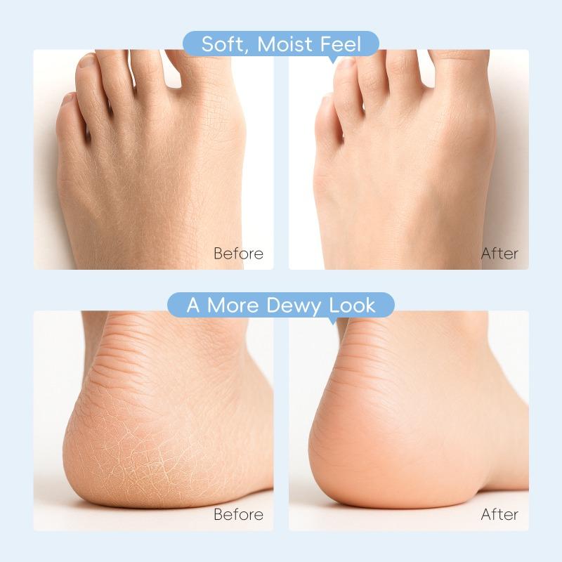 LAIKOU Milk Foot Cream 30g - Deep Moisturizing Foot Cream with Urea & Shea Butter for Dry, Cracked Heels and Rough Feet