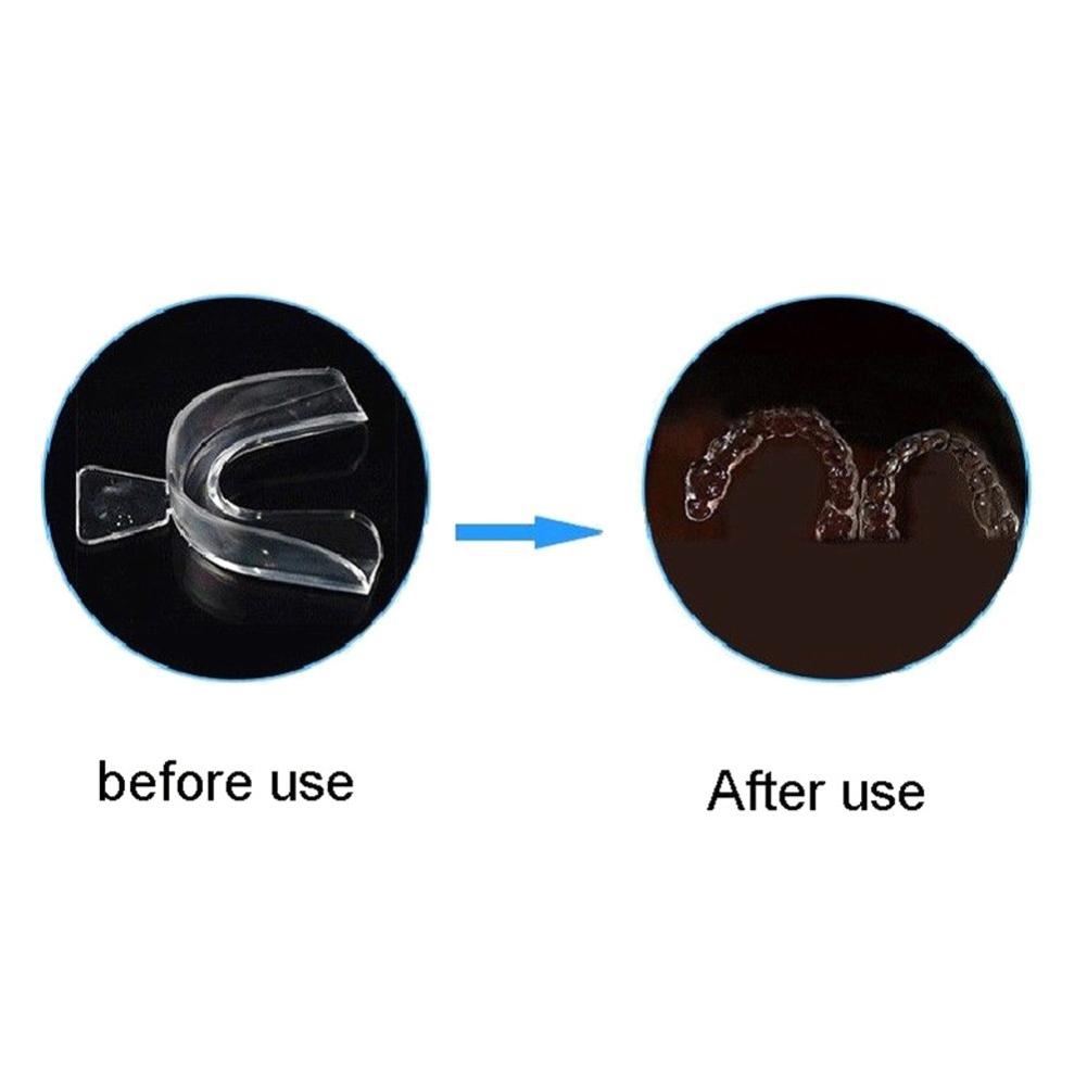 2/4pcs Soft Tooth Orthodontic Braces Set Replacement Teeth Mouth Guard Protector Whitening Trays Multi-function Hygiene Care