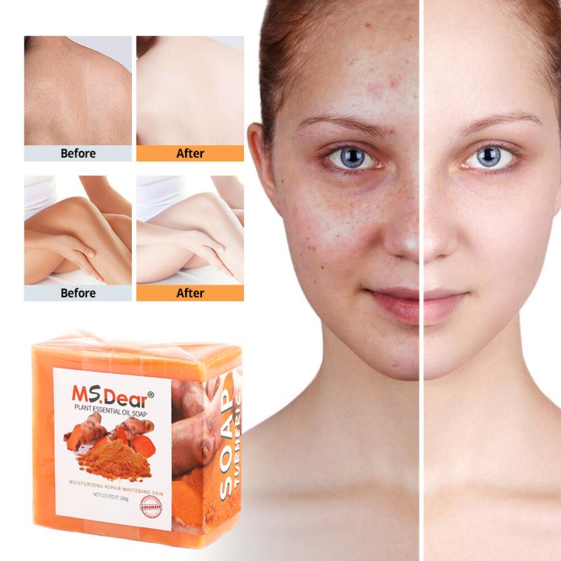 2× Turmeric Soap Skin Whitening Dark Spots Lightening Acne Brightening Turmeric