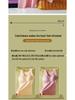 Dames Fluweel Fleece-Gevoerd Dikker Warm Vest met Borstkussentjes, Naadloze Basislaag voor Herfst/Winter
