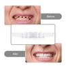 4 pieces of white dentures - adjustable upper and lower dentures for men and women, comfortable fit and natural smile