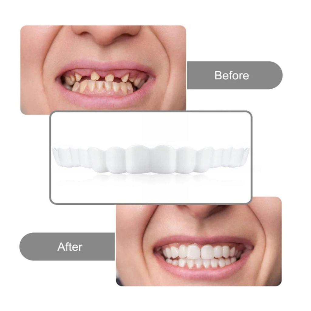 4 pieces of white dentures - adjustable upper and lower dentures for men and women, comfortable fit and natural smile