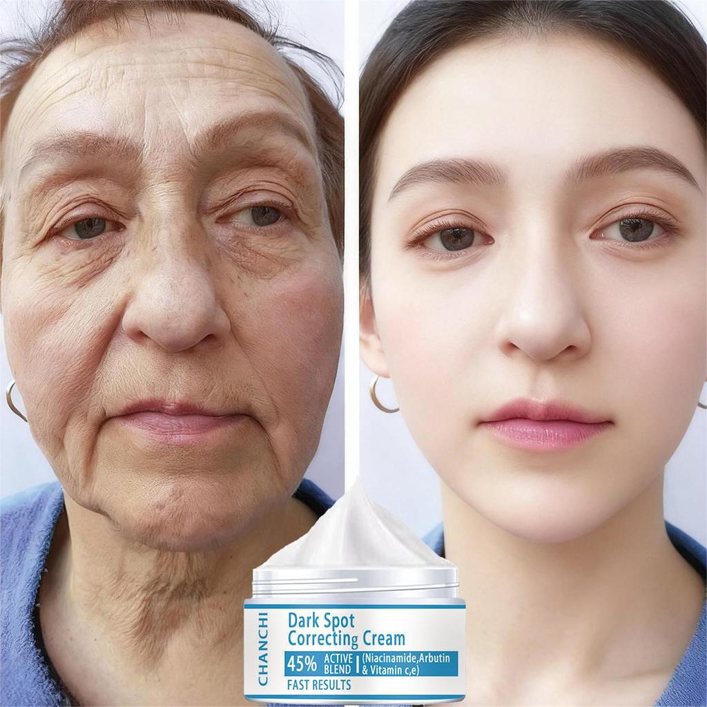 Nicotinamide Face Cream Can Lighten Fine Lines, Brighten Skin and Improve Skin