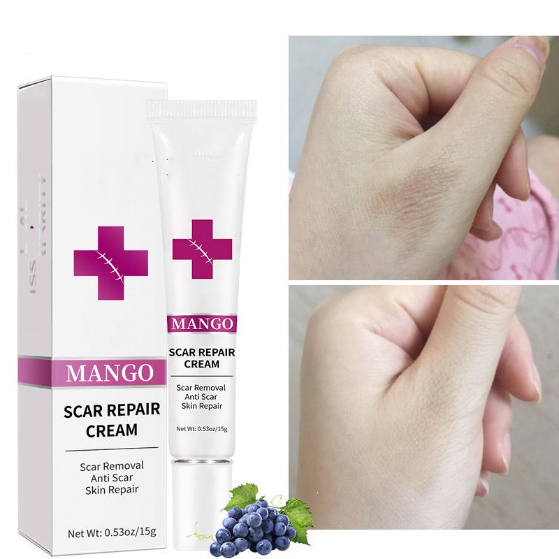 Gentle Scar Removal Paste, Scar Repairing Diminishing Skin Scar Gel, Scar Reduce Paste For All Skin Types