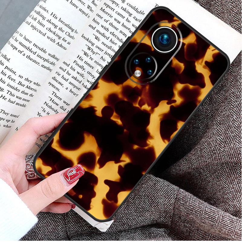 Tortoise Shell Pattern Case For Honor Magic 5 Lite 6 Pro 50 70 90 Honor X8b X9b X6 X7 X8 X9 X6a X7a X8a X9a Cover