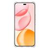 KALEBOL KLB-TPU001 For Honor 400 Pro 5G (Global) Case Airbag Corners Anti-Drop 1.5mm TPU Clear Phone Cover