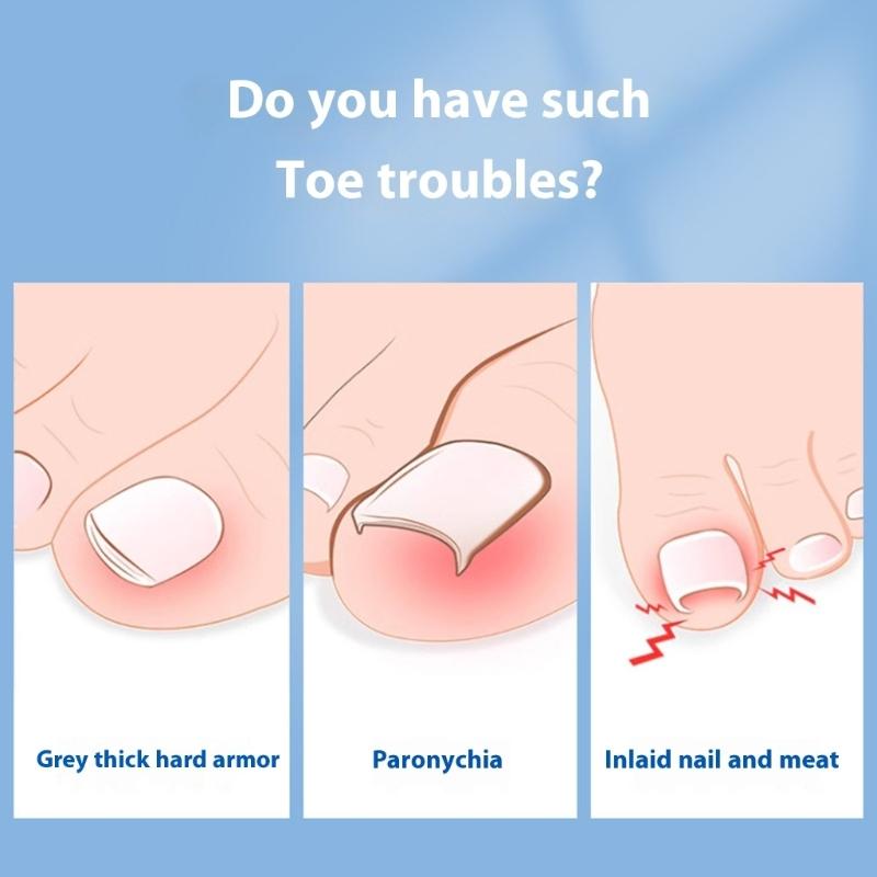 Stainless Steel Toenail Nipper With Ergonomic Grip & Sharpened Blade Suitable For Precise Nail Trimming Cuticle Removal