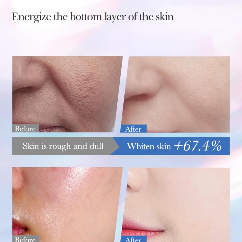 Niacinamide Whitening and Freckle Removal Cream SADOER Brightening Skin Repair Cream