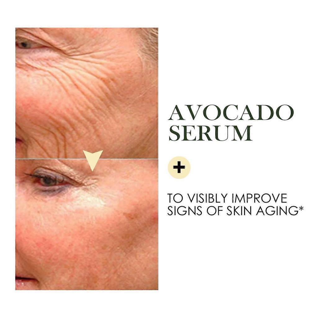 Limited time!!Eelhoe Watermelon Facial Serum Hydrates And Moisturizes, Leaves Skin Smooth And Delicate, Daily Care