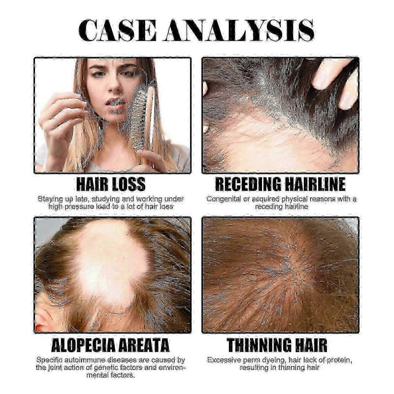 Plant Hair Hydrating Liquid Herbal Essence Moisturizes And Massages Scalp, Thickening Hair And Controlling Oil Hair Care Essential Oil