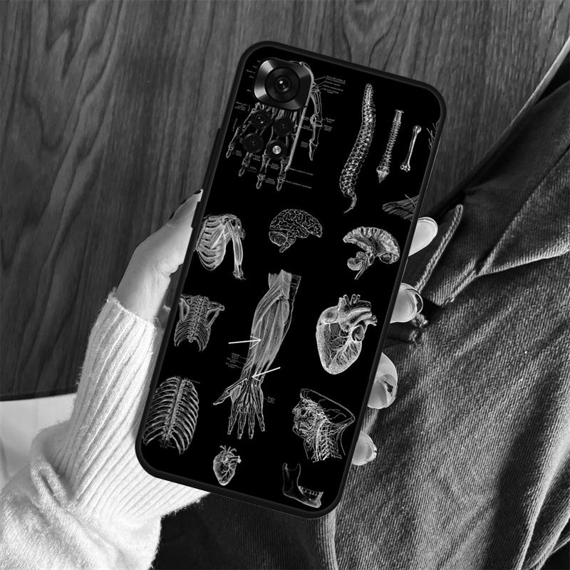 Medical Skeleton Anatomy Case For Xiaomi Redmi Note 13 14 Pro 12 11 10 15 Pro Plus Redmi 15 C 13 10C 12C 13C 14C Cover