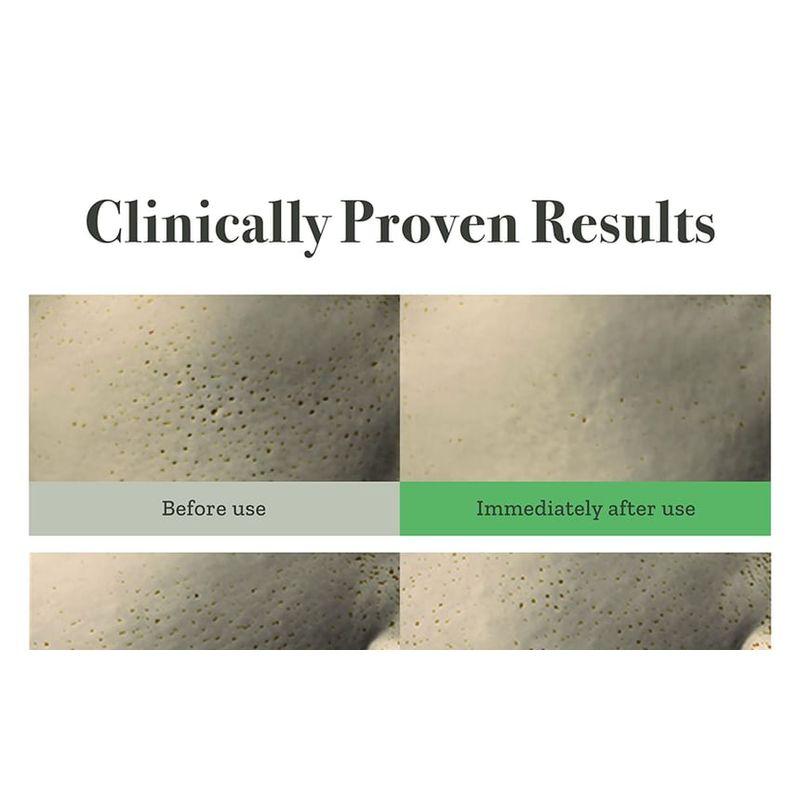 FULLY Grüne Tomaten-Serum