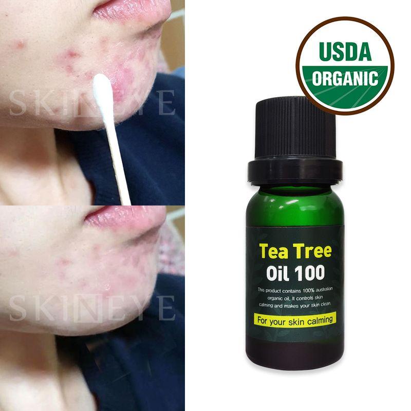 Organic Vegan Tea Tree Oil 100%