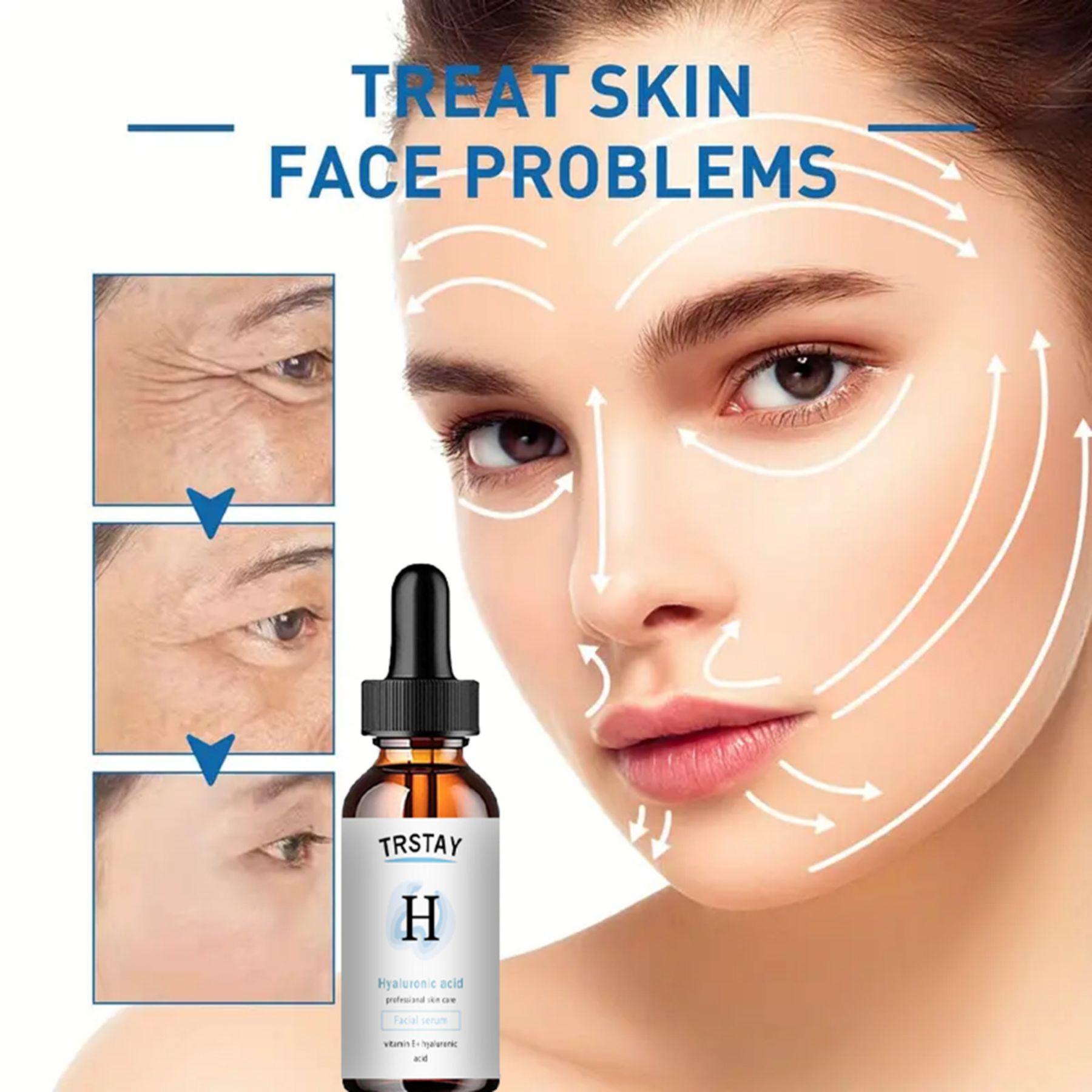 

5 мл/15 мл/30 мл/50 мл/женский отбеливающий крем для лица, крем для темной кожи, пятна, шрамы, дневной ночной крем для лица, отбеливание кожи, корейские средства по уходу за кожей