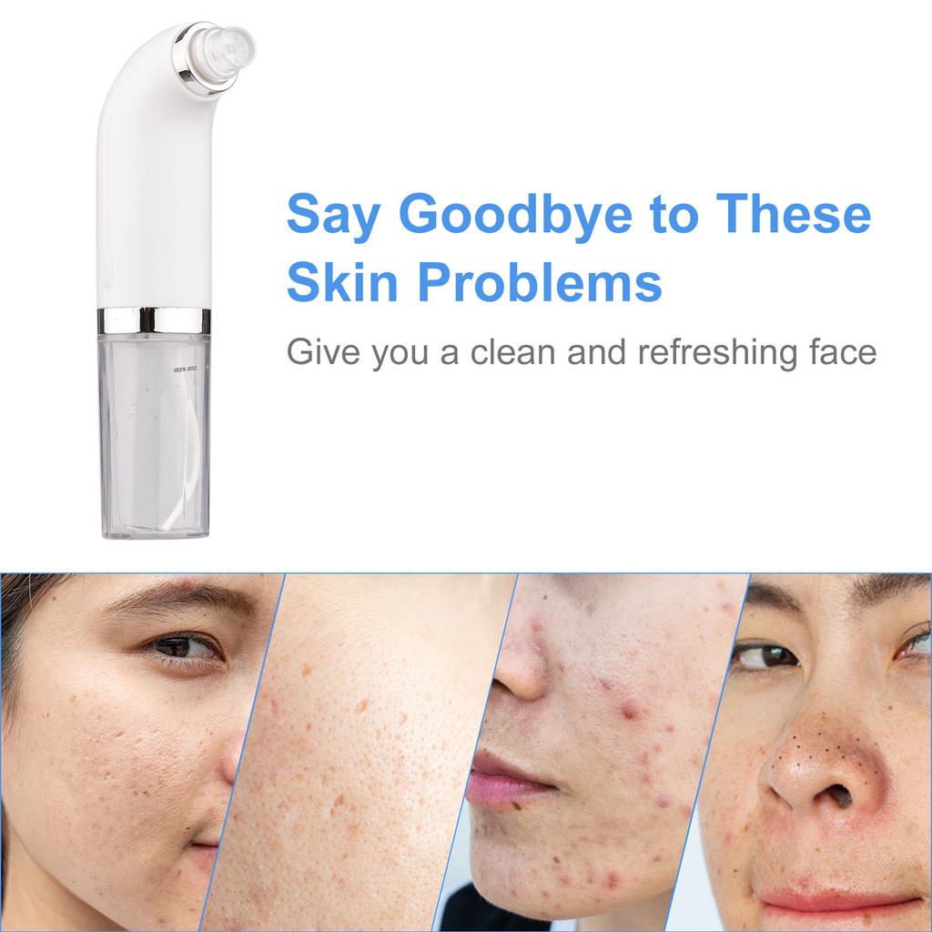 Bærbar Super Mikro Boble Skjønnhetsinstrument Elektrisk Ansiktsrenser Vannsirkulasjon Blackhead Fjerner
