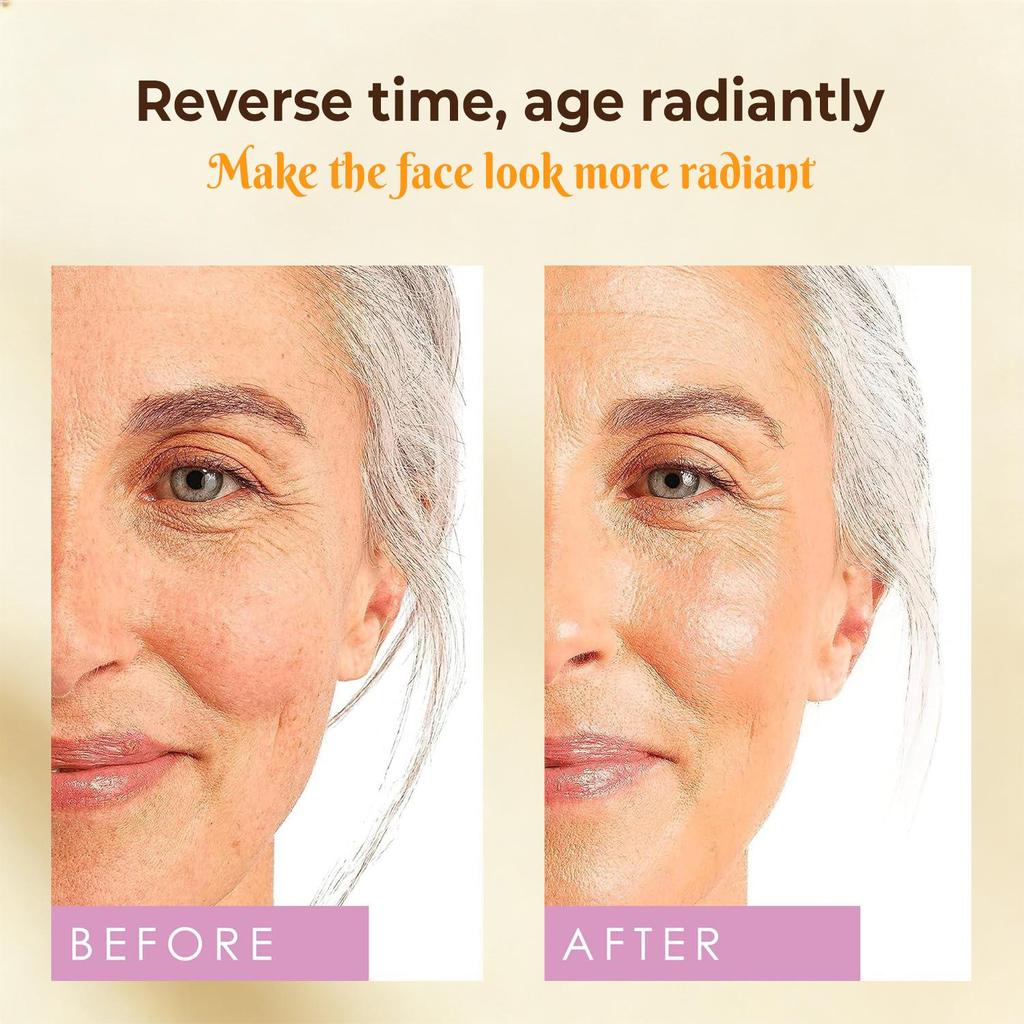 Retinol Facial Serum-Moisturizes And Htdrates The Skin To Keep The Horny Layer Moist And Soft-Suitable For All Skin Types, 30ml