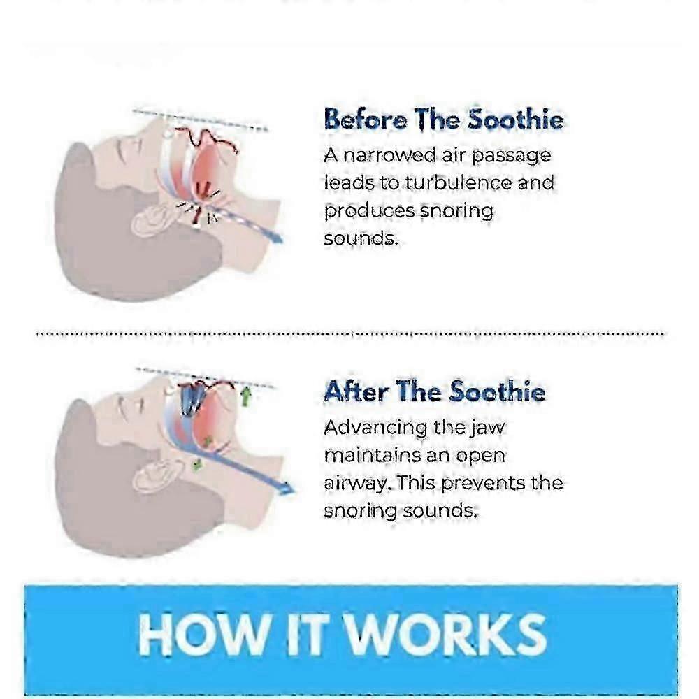 honex anti snore mouthpiece 2025