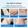 Ogas Medical Silicone Scar Repair Gel