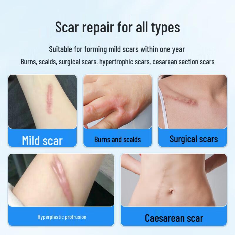 Ogas Medical Silicone Scar Repair Gel