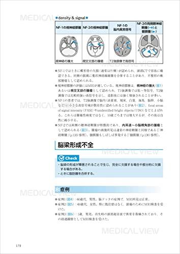 Learning from the mechanisms of the human body: Diagnostic imaging technology