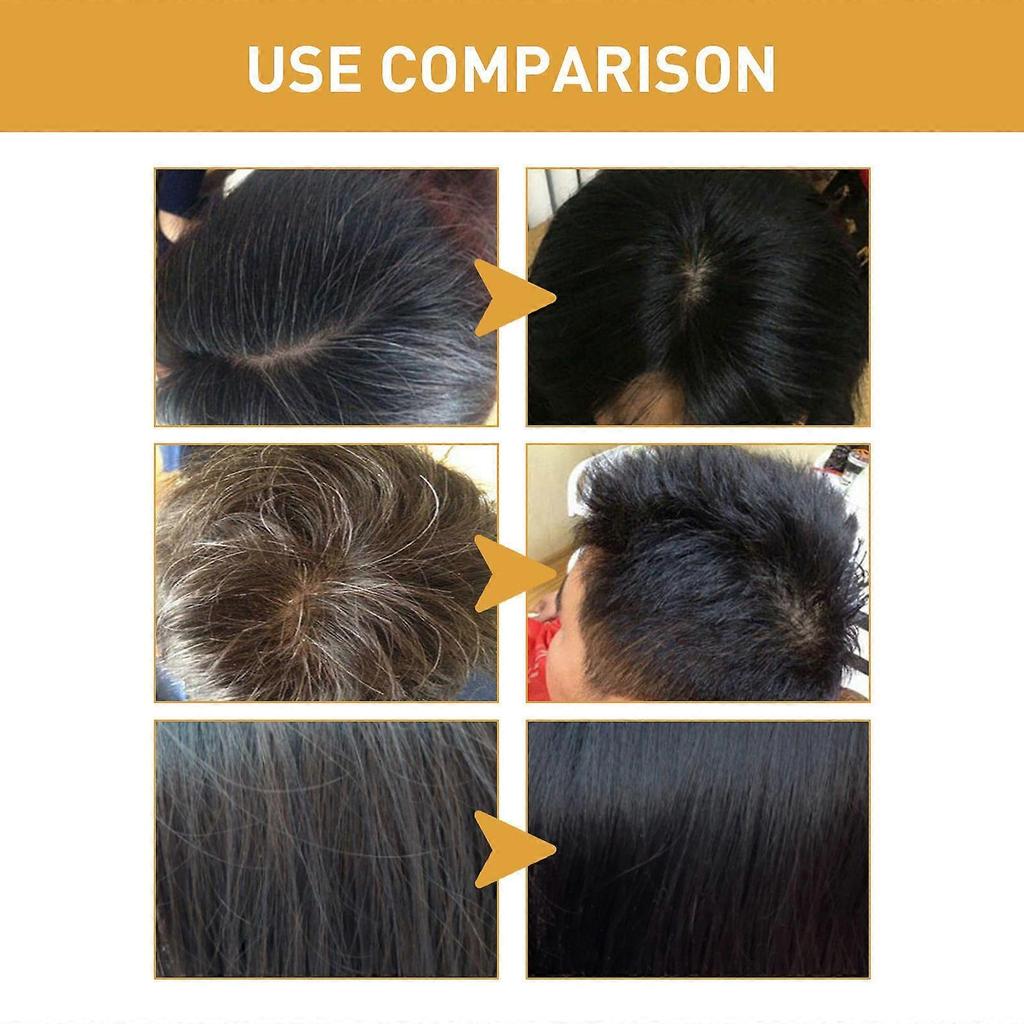 3PC Ginger Shampoo Soap Hair Loss Prevention Softening Solid Hair Repair Dry and