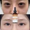 Newest Gentian Firming Eye Cream for Remove Dark Circles Eye Bags Fat Granule Anti-wrinkle Firming Reduces Appearance of Wrinkles