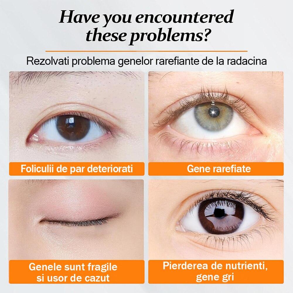 Eyelash Growth Serum 10ml – Thicker, Longer, Natural Curling, Non-Irritating, Suitable for All