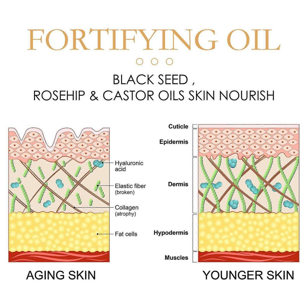 Hoygi Anti-Wrinkle And Spot Removal Essence Oil Prevents Aging, Tightens The Skin, Moisturizes And Hydrates, And Reduces Fine Lines, Nasolabial Folds