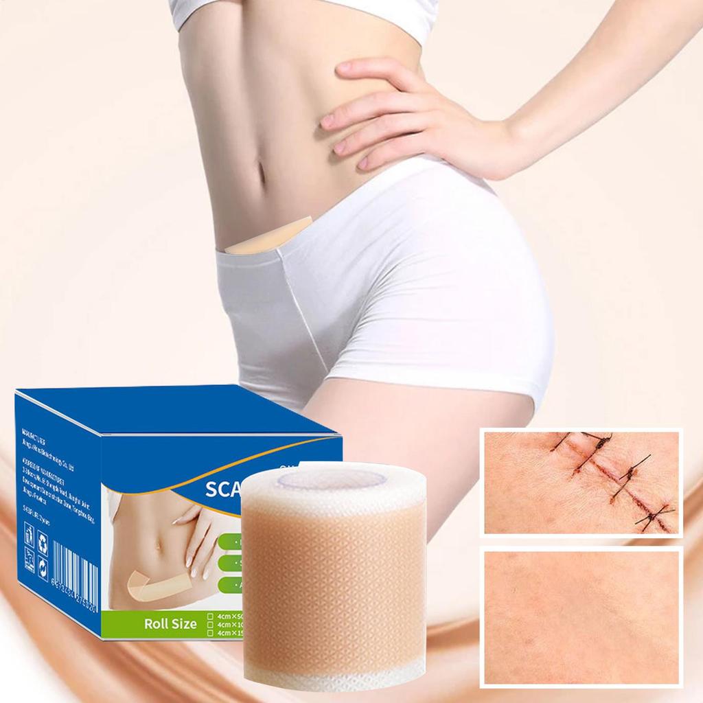 1 Roll Silicone Scar Sheets ,4cm X 50cm Silicone Scar Sheets ,Self-Adhesive Scar Cover Tape Skin Care Waterproof and Breathable