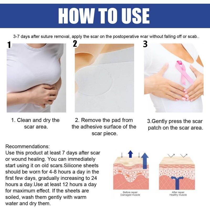 Silicone Scar Breast Sheets Skin Repair Bust Treatment Tools Sticker