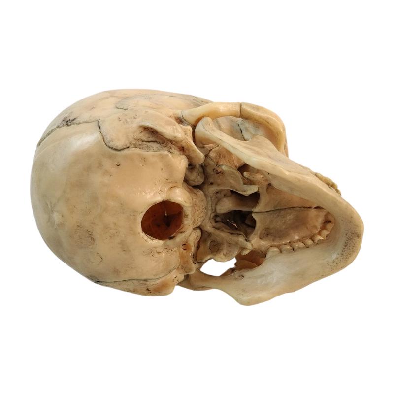 Detachable Colored Skull Model - 15 Parts for Medical, Aesthetic & Dental Teaching