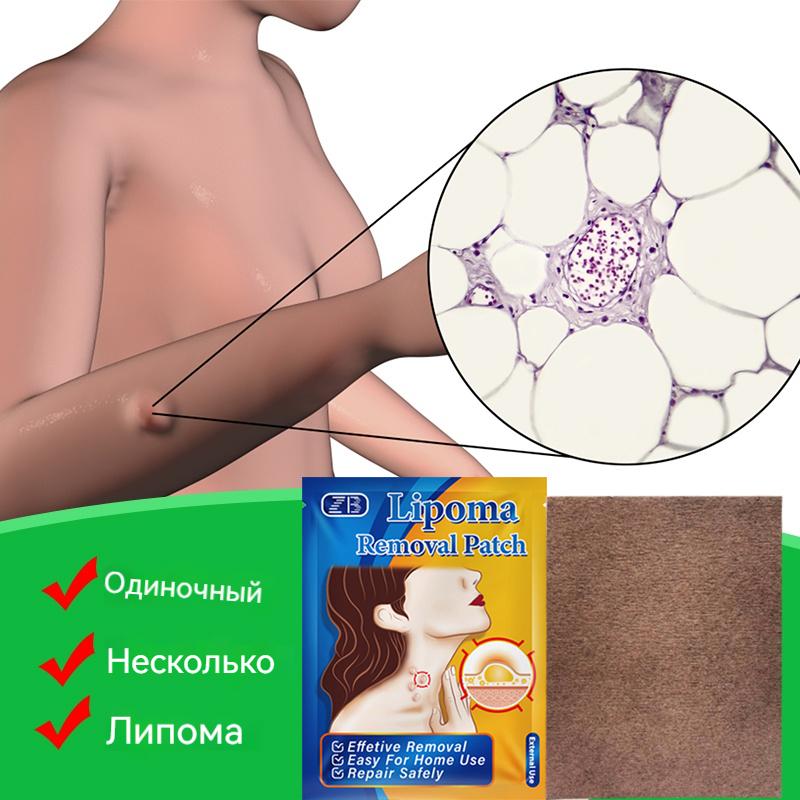 ZB Lipoma Patch Natural Herbal Lipoma Lump Removal Patches, Lipoma Removal Stickers 6pcs/bag