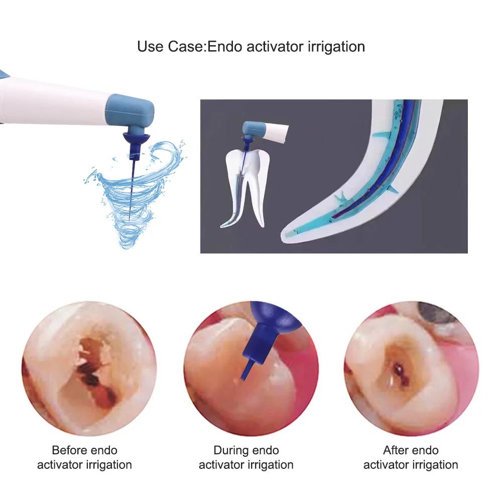 Aktywator Endodontyczny do Gabinetu Stomatologicznego Endo Leczenie Kanałowe z 60 Końcówkami Sonicznymi Irygatora Narzędzia Stomatologiczne