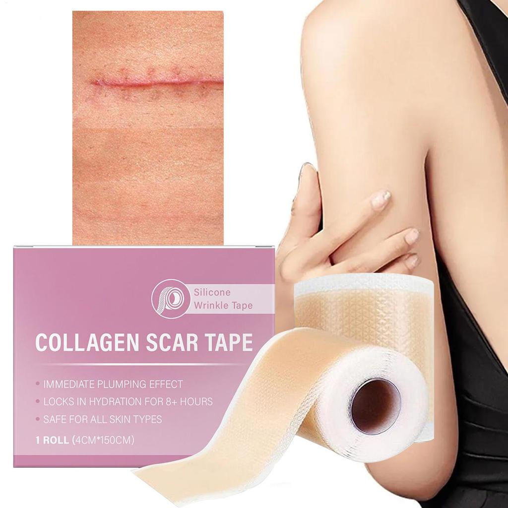 Scar Sheets 1 Roll Self-Adhesive Scar Cover Tape Skin Care Waterproof and Breathable