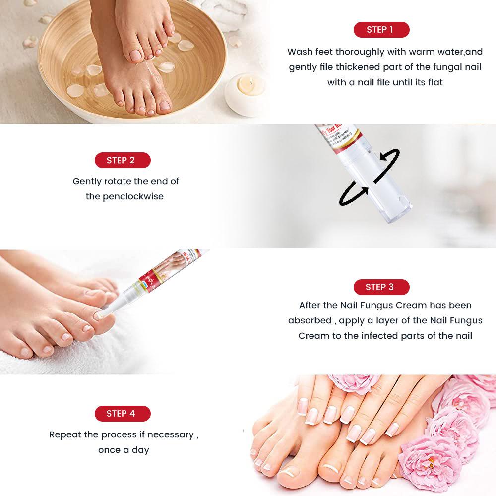 Sumifun 4/8/20 ML Nagelreparatur Flüssigstift Nähren Feuchtigkeitsspenden Graue Nägel Antimykotisch Nagelgesunde Pflege Lösen Mehrere Nagelprobleme