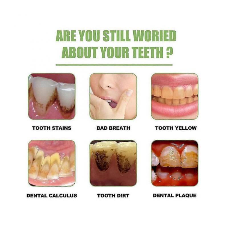 Ampoule Toothpaste,ampoule Tooth Serum, Ampoule Essence Toothpaste,fruit Acid Teeth Whitening Essence (1box/10pcs)