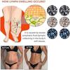 Acupuncture Earrings Magnetherapy Germanium Earrings for Weight Loss Lymphatic Drainage Earrings