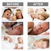 XIMONTH Nursing Nasal StripNighttime Sleeping ConditionDiscomfortOpen MouthSnoringSnoring Nursing Nasal Strip