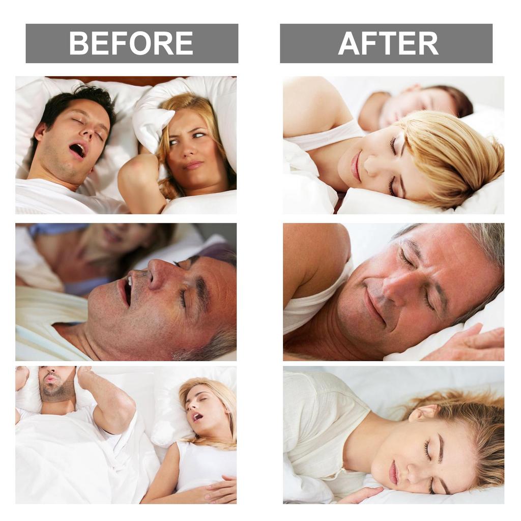 XIMONTH Nursing Nasal StripNighttime Sleeping ConditionDiscomfortOpen MouthSnoringSnoring Nursing Nasal Strip