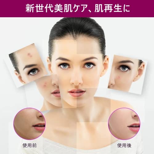 SrDiot Derma Roller, 0.5mm Microneedle Facial Roller for Beautiful Skin, Scalp, Dark Spots, Thinning Hair, Pore Care, Face Care, Unisex (Black)