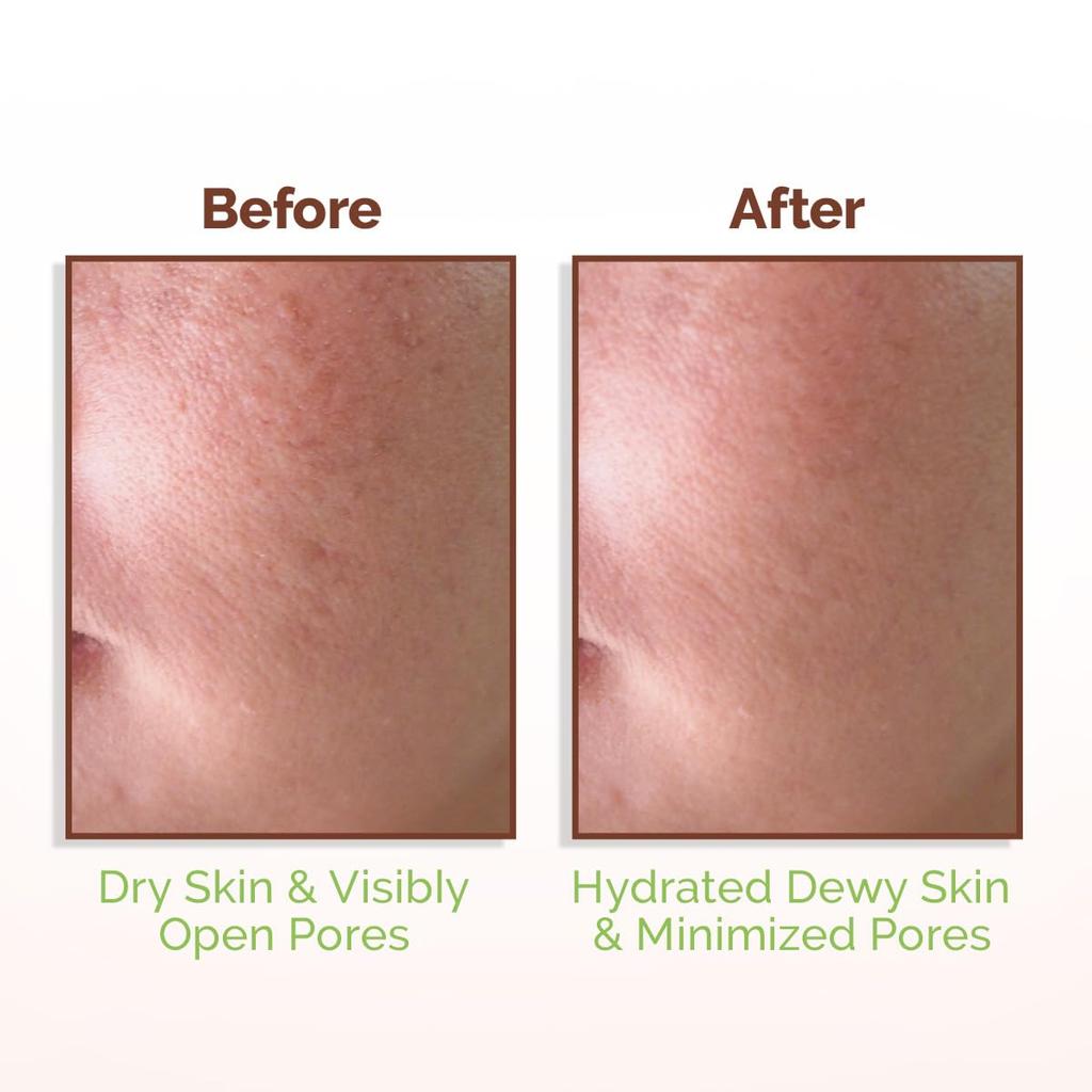 Mamaearth Rice Water Dewy Face Toner 150 ml Pack of 1 | Hydrating Glass Skin Toner for Pore Minimizing & Even Skin Tone