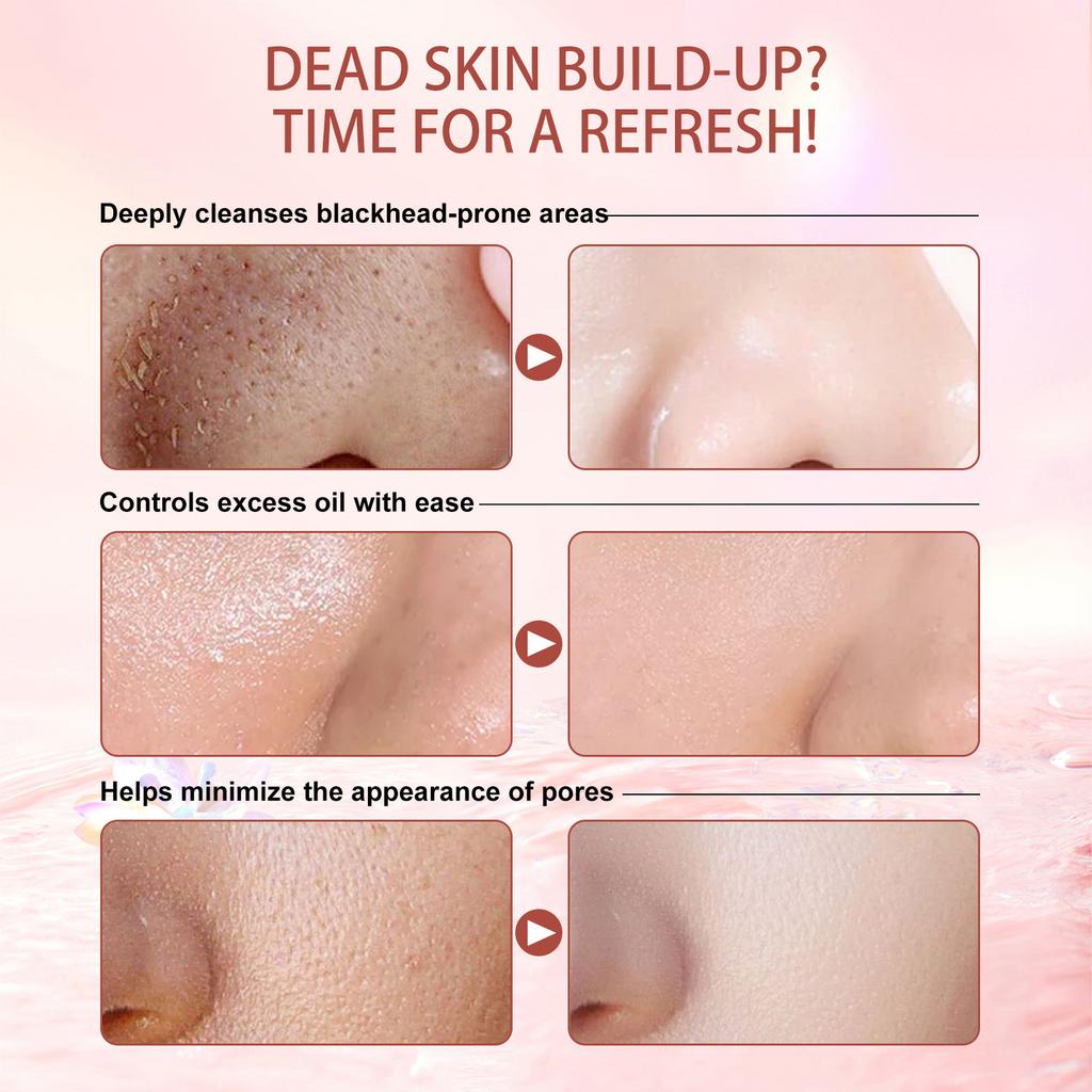 Exfoliating Gel Deep Cleansing, Moisturizing, Brightening, Multi-part Exfoliating Gel 50g