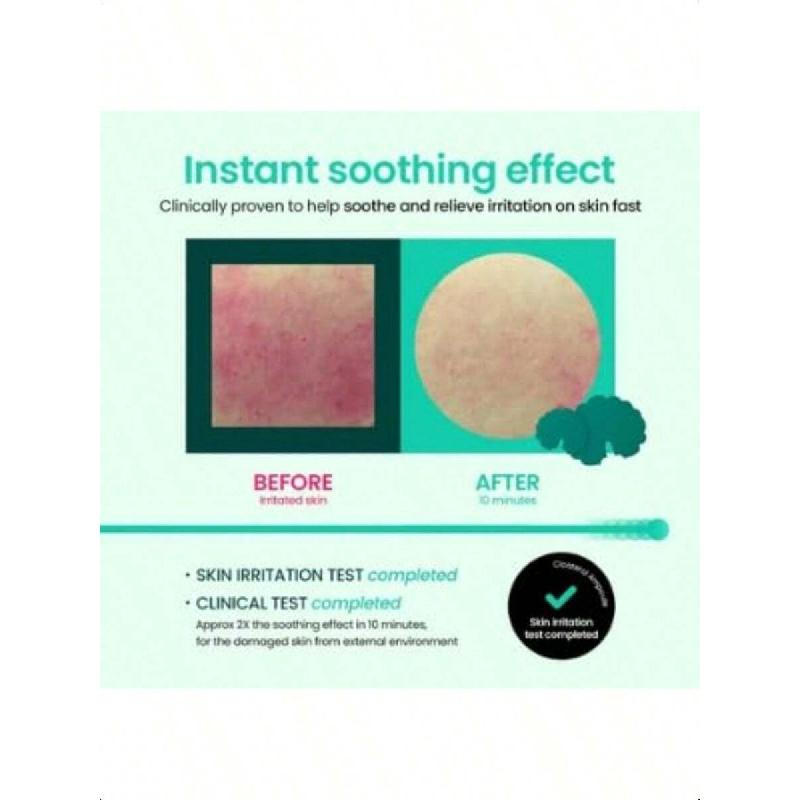 Beplain Cicaterol Ansiktsserum 30ml | Kraftfull Lugnande & Återhämtande Formula För Irriterad, Känslig Hud