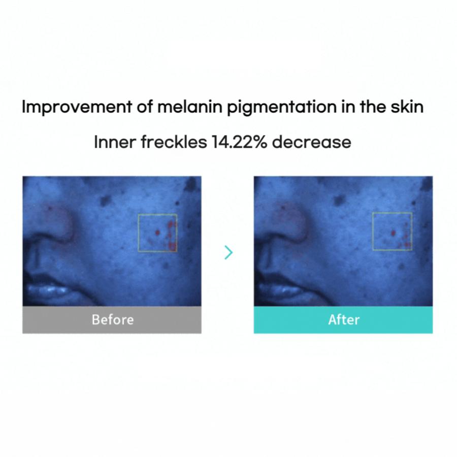 Rejuran Biome Healer Youth Formula Cream 50ml