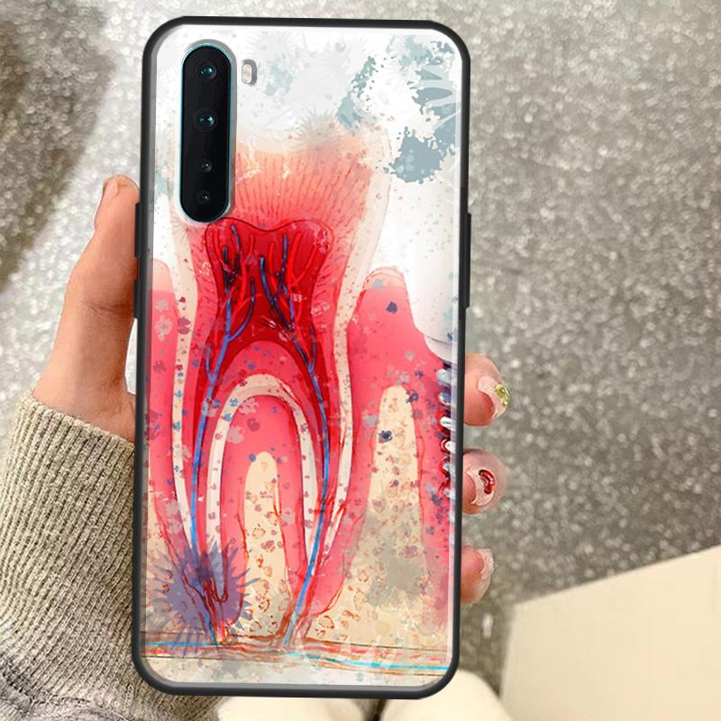 Human Tooth Anatomy Case For OnePlus 13T 10T 8T 10 Pro 15 13 12 11 15R 13R 12R Nord CE 5 2 3 4 Lite N20 N30 Coque