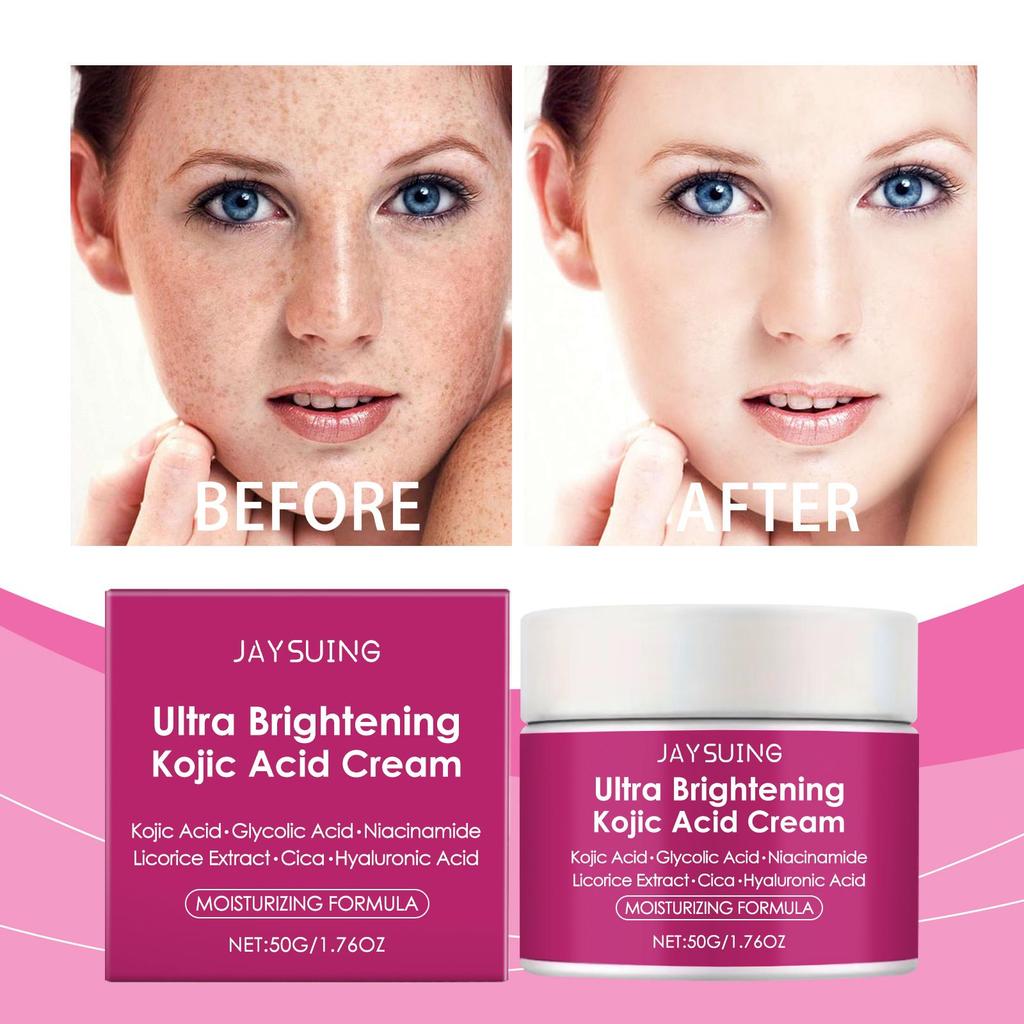Kojic Acid Facial Cream Lighten Skin Tone Moisturizing Hydrating Smoothing Firm Face Reduce Dryness Discomfort Niacinamide Cream