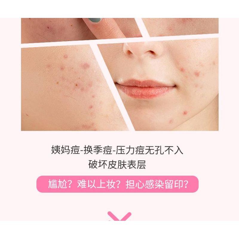 YAOZHI - Cute Radiance Acne Pimple Patch (Trial Size) - 3 Types